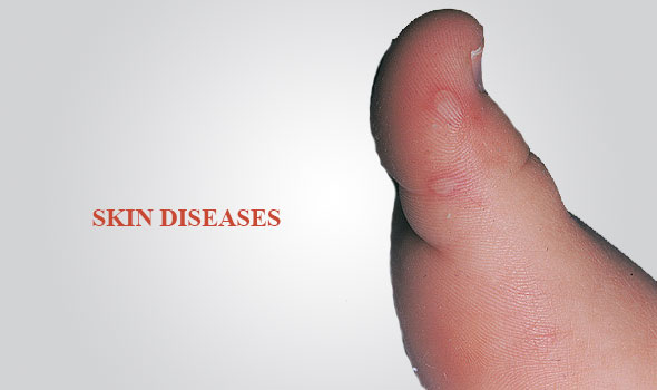 best_ayurvedic_resorts_in_kerala